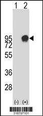 Western blot analysis of his-tag KIRREL (arrow) using his tag antibody. 293T cell lysates (2 ug/lane) either nontransfected (Lane 1) or transiently transfected with the KIRREL gene‘