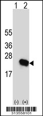 Western blot analysis of his-tag STMN1 (arrow) using his tag antibody. 293 cell lysates (2 ug/lane) either nontransfected (Lane 1) or transiently transfected with the STMN1 gene
