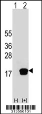 Western blot analysis of his-tag RAMP1 (arrow) using his tag antibody. 293 cell lysates (2 ug/lane) either nontransfected (Lane 1) or transiently transfected with the RAMP1 gene
