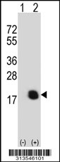 Western blot analysis of his-tag AP1S1 (arrow) using his tag antibody. 293 cell lysates (2 ug/lane) either nontransfected (Lane 1) or transiently transfected with the AP1S1 gene