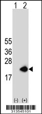 Western blot analysis of his-tag RPL28 (arrow) using his tag antibody. 293 cell lysates (2 ug/lane) either nontransfected (Lane 1) or transiently transfected with the RPL28 gene