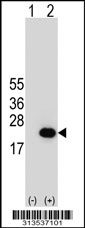 Western blot analysis of his-tag SNCG (arrow) using his tag antibody. 293 cell lysates (2 ug/lane) either nontransfected (Lane 1) or transiently transfected with the SNCG gene