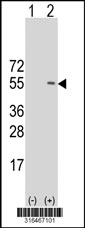Western blot analysis of his-tag PNMA5 (arrow) using his tag antibody. 293T cell lysates (2 ug/lane) either nontransfected (Lane 1) or transiently transfected with the PNMA5 gene‘