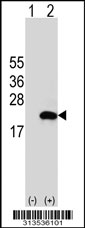 Western blot analysis of his-tag LLPH (arrow) using his tag antibody. 293 cell lysates (2 ug/lane) either nontransfected (Lane 1) or transiently transfected with the LLPH gene
