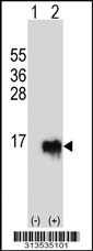 Western blot analysis of his-tag ZNRD1 (arrow) using his tag antibody. 293 cell lysates (2 ug/lane) either nontransfected (Lane 1) or transiently transfected with the ZNRD1 gene