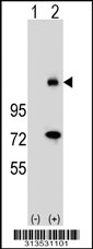 Western blot analysis of his-tag FOXM1 (arrow) using his tag antibody. 293 cell lysates (2 ug/lane) either nontransfected (Lane 1) or transiently transfected with the FOXM1 gene