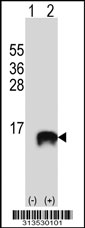 Western blot analysis of his-tag POLR2I (arrow) using his tag antibody. 293 cell lysates (2 ug/lane) either nontransfected (Lane 1) or transiently transfected with the POLR2I gene