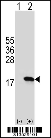 Western blot analysis of his-tag RPS25 (arrow) using his tag antibody. 293 cell lysates (2 ug/lane) either nontransfected (Lane 1) or transiently transfected with the RPS25 gene