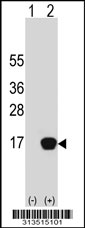 Western blot analysis of his-tag C8orf4 (arrow) using his tag antibody. 293 cell lysates (2 ug/lane) either nontransfected (Lane 1) or transiently transfected with the C8orf4 gene