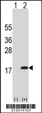 Western blot analysis of his-tag UQCRB (arrow) using his tag antibody. 293 cell lysates (2 ug/lane) either nontransfected (Lane 1) or transiently transfected with the UQCRB gene