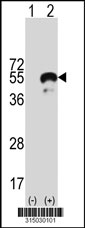 Western blot analysis of his-tag RANGAP1 (arrow) using his tag antibody. 293T cell lysates (2 ug/lane) either nontransfected (Lane 1) or transiently transfected with the RANGAP1 gene‘