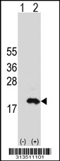 Western blot analysis of his-tag DDA1 (arrow) using his tag antibody. 293 cell lysates (2 ug/lane) either nontransfected (Lane 1) or transiently transfected with the DDA1 gene