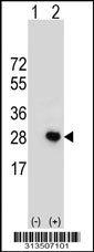 Western blot analysis of his-tag PAGE4 (arrow) using his tag antibody. 293 cell lysates (2 ug/lane) either nontransfected (Lane 1) or transiently transfected with the PAGE4 gene.