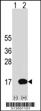 Western blot analysis of his-tag UQCRQ (arrow) using his tag antibody. 293 cell lysates (2 ug/lane) either nontransfected (Lane 1) or transiently transfected with the UQCRQ gene
