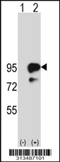 Western blot analysis of his-tag KIF2C (arrow) using his tag antibody. 293 cell lysates (2 ug/lane) either nontransfected (Lane 1) or transiently transfected with the KIF2C gene