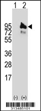 Western blot analysis of his-tag APBB1 (arrow) using his tag antibody. 293 cell lysates (2 ug/lane) either nontransfected (Lane 1) or transiently transfected with the APBB1 gene