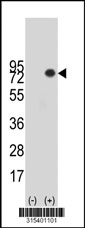 Western blot analysis of his-tag LZTS2 (arrow) using his tag antibody. 293T cell lysates (2 ug/lane) either nontransfected (Lane 1) or transiently transfected with the LZTS2 gene‘