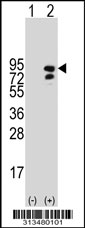 Western blot analysis of his-tag FXR2 (arrow) using his tag antibody. 293 cell lysates (2 ug/lane) either nontransfected (Lane 1) or transiently transfected with the FXR2 gene.