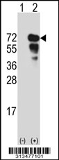 Western blot analysis of his-tag CEP72 (arrow) using his tag antibody. 293 cell lysates (2 ug/lane) either nontransfected (Lane 1) or transiently transfected with the CEP72 gene