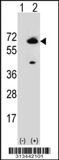 Western blot analysis of his-tag ZGPAT (arrow) using his tag antibody. 293 cell lysates (2 ug/lane) either nontransfected (Lane 1) or transiently transfected with the ZGPAT gene