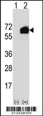 Western blot analysis of his-tag CARD9 (arrow) using his tag antibody. 293 cell lysates (2 ug/lane) either nontransfected (Lane 1) or transiently transfected with the CARD9 gene