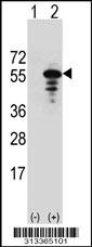 Western blot analysis of his-tag BEND5 (arrow) using his tag antibody. 293 cell lysates (2 ug/lane) either nontransfected (Lane 1) or transiently transfected with the BEND5 gene