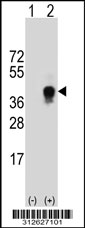 Western blot analysis of his-tag FCGR3A (arrow) using his tag antibody. 293 cell lysates (2 ug/lane) either nontransfected (Lane 1) or transiently transfected with the FCGR3A gene.