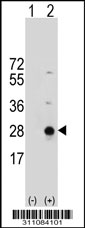 Western blot analysis of his-tag ICOS (arrow) using his tag antibody. 293 cell lysates (2 ug/lane) either nontransfected (Lane 1) or transiently transfected with the ICOS gene.