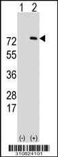 Western blot analysis of his-tag MMP9 (arrow) using his tag antibody. 293 cell lysates (2 ug/lane) either nontransfected (Lane 1) or transiently transfected with the MMP9 gene.