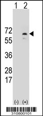 Western blot analysis of his-tag AFP (arrow) using his tag antibody. 293 cell lysates (2 ug/lane) either nontransfected (Lane 1) or transiently transfected with the AFP gene.