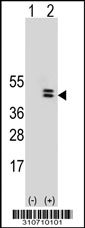 Western blot analysis of his-tag RDBP (arrow) using his tag antibody. 293 cell lysates (2 ug/lane) either nontransfected (Lane 1) or transiently transfected with the RDBP gene.