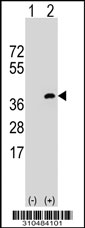 Western blot analysis of his-tag TNFRSF11B (arrow) using his tag antibody. 293 cell lysates (2 ug/lane) either nontransfected (Lane 1) or transiently transfected with the TNFRSF11B gene.