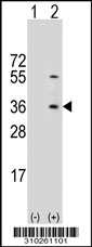 Western blot analysis of his-tag MAT1A (arrow) using his tag antibody. 293 cell lysates (2 ug/lane) either nontransfected (Lane 1) or transiently transfected with the MAT1A gene.