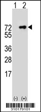Western blot analysis of his-tag RXRB (arrow) using his tag antibody. 293 cell lysates (2 ug/lane) either nontransfected (Lane 1) or transiently transfected with the RXRB gene.