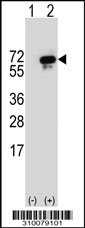 Western blot analysis of his-tag TESK2 (arrow) using his tag antibody. 293 cell lysates (2 ug/lane) either nontransfected (Lane 1) or transiently transfected with the TESK2 gene.