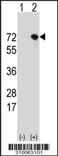 Western blot analysis of his-tag MEX3B (arrow) using his tag antibody. 293 cell lysates (2 ug/lane) either nontransfected (Lane 1) or transiently transfected with the MEX3B gene.
