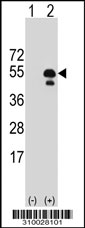 Western blot analysis of his-tag PAX8 (arrow) using his tag antibody. 293 cell lysates (2 ug/lane) either nontransfected (Lane 1) or transiently transfected with the PAX8 gene.