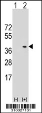 Western blot analysis of his-tag CSNK1A1L (arrow) using his tag antibody. 293 cell lysates (2 ug/lane) either nontransfected (Lane 1) or transiently transfected with the CSNK1A1L gene.