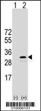 Western blot analysis of his-tag ALS2CR7 (arrow) using his tag antibody. 293 cell lysates (2 ug/lane) either nontransfected (Lane 1) or transiently transfected with the ALS2CR7 gene.