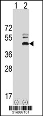Western blot analysis of his-tag PHF21B (arrow) using his tag antibody. 293T cell lysates (2 ug/lane) either nontransfected (Lane 1) or transiently transfected with the PHF21B gene‘