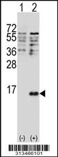 Western blot analysis of his-tag CXCL11 (arrow) using his tag antibody. 293 cell lysates (2 ug/lane) either nontransfected (Lane 1) or transiently transfected with the gene
