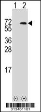 Western blot analysis of his-tag AOAH (arrow) using his tag antibody. 293 cell lysates (2 ug/lane) either nontransfected (Lane 1) or transiently transfected with the gene