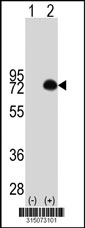 Western blot analysis of his-tag RACGAP1 (arrow) using his tag antibody. 293T cell lysates (2 ug/lane) either nontransfected (Lane 1) or transiently transfected with the RACGAP1 gene‘
