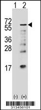 Western blot analysis of his-tag PUF60 (arrow) using his tag antibody. 293 cell lysates (2 ug/lane) either nontransfected (Lane 1) or transiently transfected with the gene