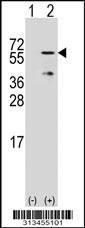 Western blot analysis of his-tag MTMR9 (arrow) using his tag antibody. 293 cell lysates (2 ug/lane) either nontransfected (Lane 1) or transiently transfected with the gene
