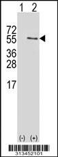 Western blot analysis of his-tag POLR3C (arrow) using his tag antibody. 293 cell lysates (2 ug/lane) either nontransfected (Lane 1) or transiently transfected with the gene