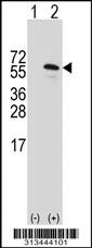 Western blot analysis of his-tag C22orf28 (arrow) using his tag antibody. 293 cell lysates (2 ug/lane) either nontransfected (Lane 1) or transiently transfected with the gene