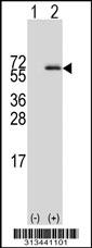 Western blot analysis of his-tag SF3A3 (arrow) using his tag antibody. 293 cell lysates (2 ug/lane) either nontransfected (Lane 1) or transiently transfected with the gene