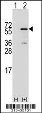 Western blot analysis of his-tag IFIT5 (arrow) using his tag antibody. 293 cell lysates (2 ug/lane) either nontransfected (Lane 1) or transiently transfected with the gene