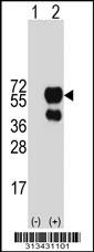 Western blot analysis of his-tag TNFRSF21 (arrow) using his tag antibody. 293 cell lysates (2 ug/lane) either nontransfected (Lane 1) or transiently transfected with the gene